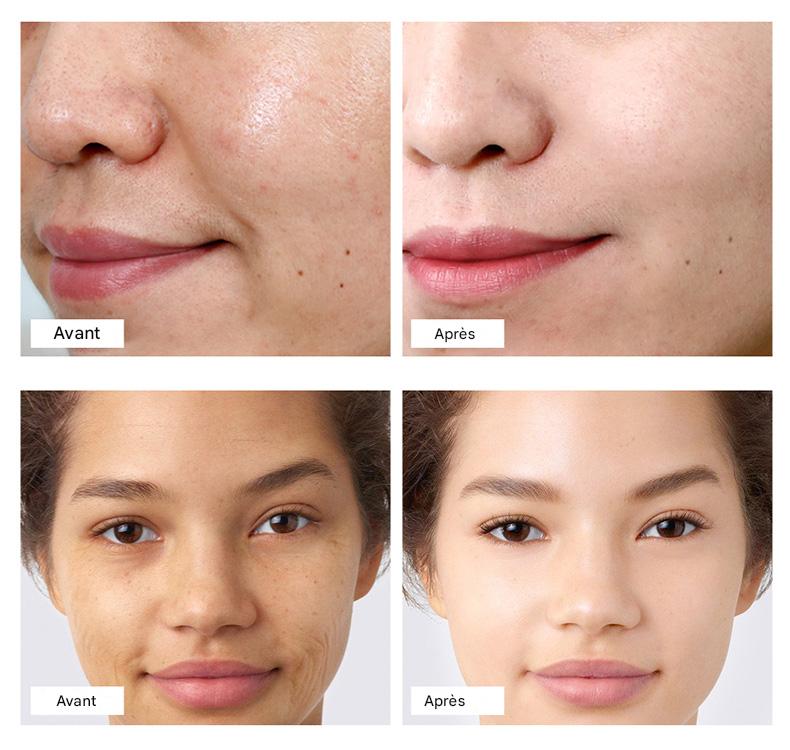 Crème Visage Rétinol Acide Hyaluronique – Anti-Âge & Éclat Quotidien